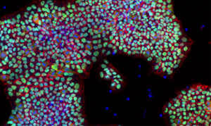 Human embryonic stem cell line HUES1 grown in the new conditions E8+Inter-alpha-inhibitor and imaged for stem cell marker Oct4 (green) and cell-cell attachment molecule E-cadherin (red) with nuclear counter-staining (blue). Credit: Dr. Sara Pijuan-Galito and Dr. Cathy Merry, Wolfson Centre for Stem Cells, Tissue Engineering & Modelling and Centre for Biomolecular Sciences, The University of Nottingham Read more at: http://phys.org/news/2016-07-breakthrough-scaling-life-changing-stem-cell_line