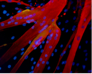 Muscle fibres formed in the lab by human mesoangioblasts (image: eurostemcell)