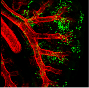 lung stem cell therapies