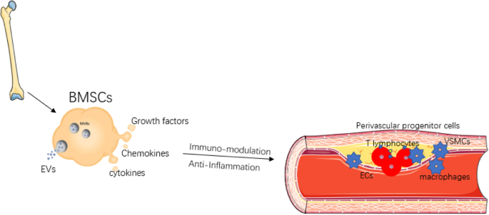 Atherosclerosis obliterans grade IV