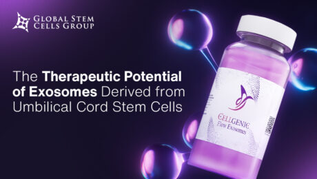 Exosome therapy